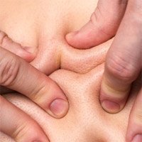 Пять доводов в пользу антицеллюлитного массажа